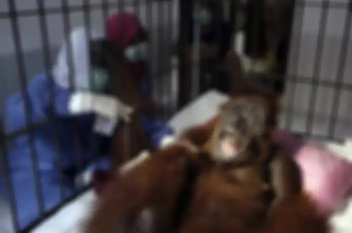X-ray menunjukkan ada 74 peluru yang mengenai tubuh Hope. Dan empat di antaranya mengenai mata kirinya dan dua lainnya mengenai mata kanannya.