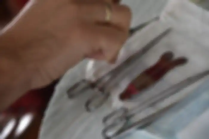 Meski tujuannya sama, ternyata prosedur sunat bagi orang dewasa bisa dikatakan gampang-gampang susah.