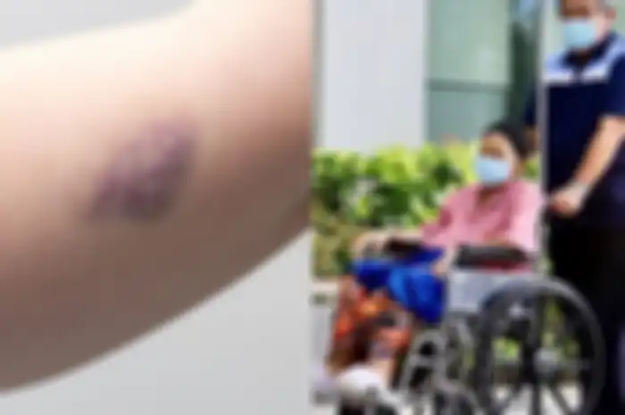 Berikut gejala kanker darah seperti yang dialami Ani Yudhoyono. Sepele, tapi sering diabaikan. Ketahui 5 gejala leukimia yang mungkin belum diketahui!