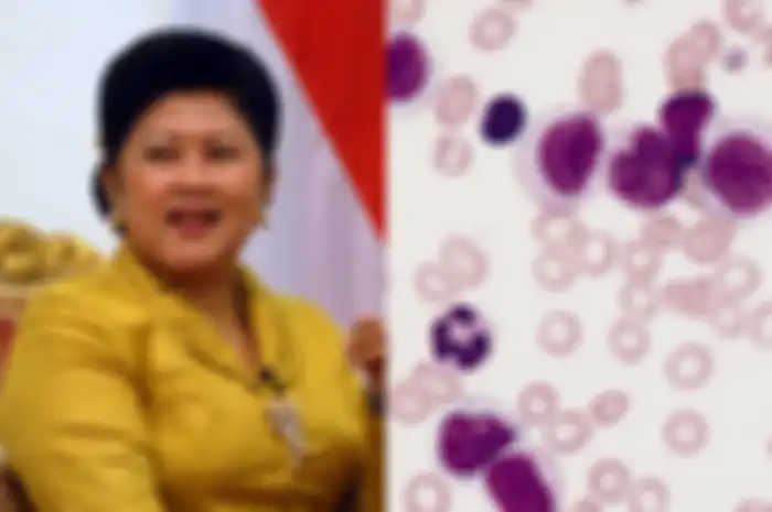 Para ilmuwan mengatakan bahwa mereka menemukan cara yang membuat sel-sel leukemia mampu menghancurkan diri mereka sendiri.