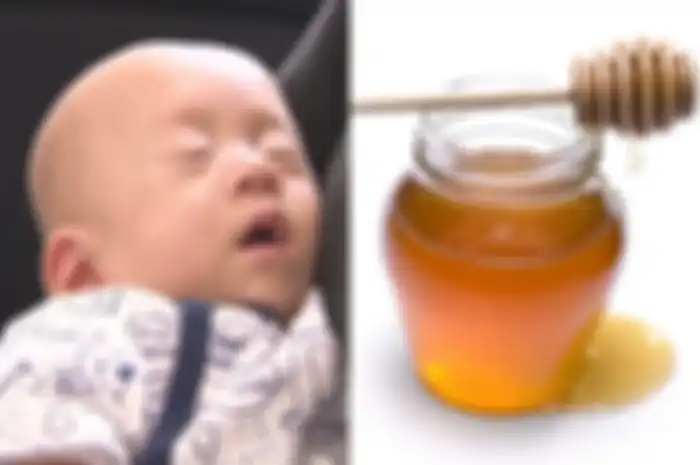 Seorang bayi laki-laki berusia 6 bulan meninggal setelah keluarganya memberi bayi ini madu. Bayi ini menderita botulisme pada bayi. Apa itu?