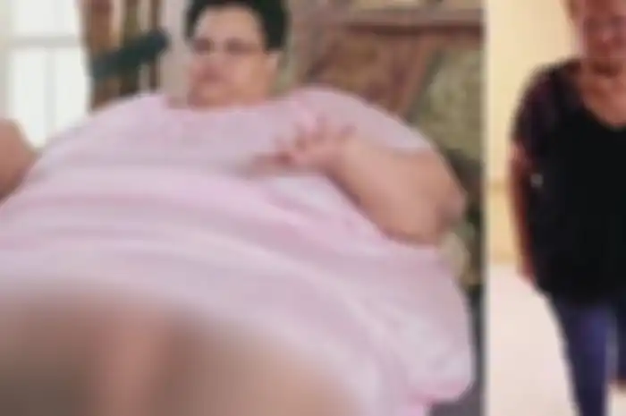 Dengan berat badan 340kg, Milla hanya bisa terbaring di tempat tidur dan tak dapat melakukan apapun untuk dirinya sendiri