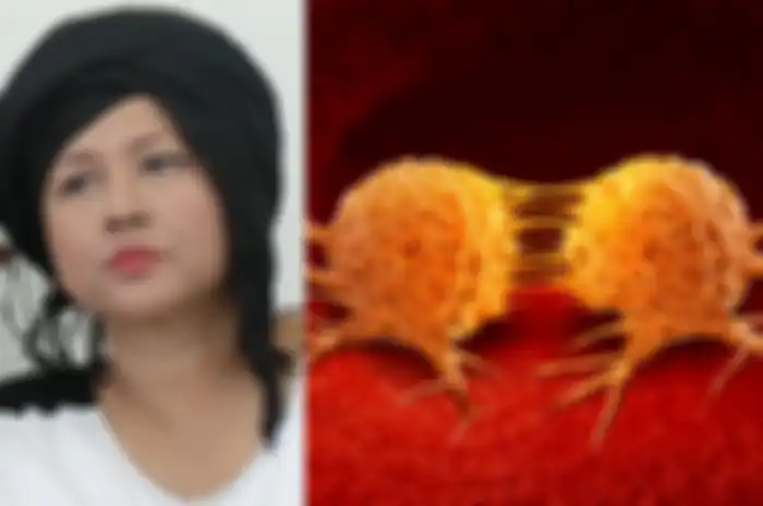 Artis Ria Irawan menyerah pada kanker yang diidapnya, sang kakak bongkar kebiasaan buruk yang jadi penyebab sakitnya.