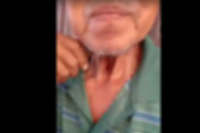  sebuah video yang memperlihatkan seorang bapak-bapak dengan tenggorokan berlubang beredar di aplikasi berbagi pesan Whatsapp.