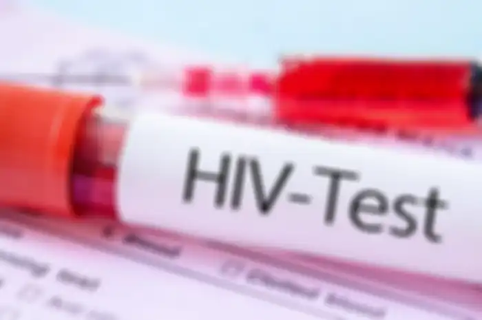 Calon pengantin di Kabupaten Cianjur, Jawa Barat, wajib melakukan tes HIV (human immunodeficiency virus) sebelum menikah.