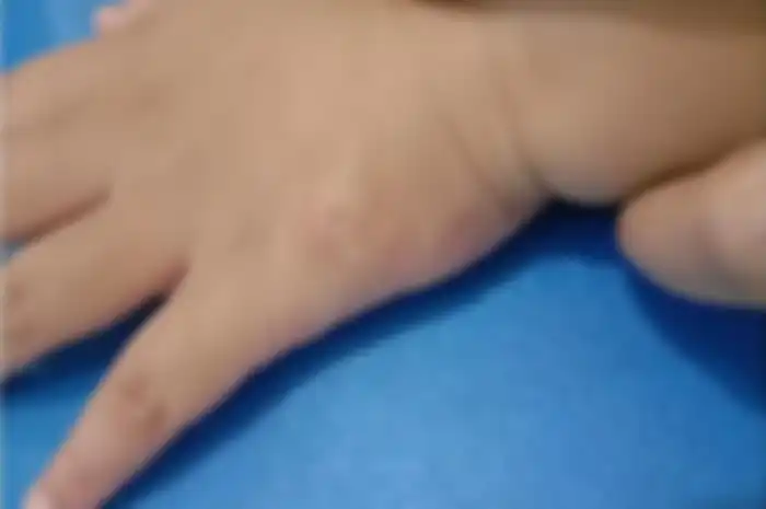 Terdapat cacing di bawah kulit anak Anji, kok bisa terjadi? Apa yang menyebabkan kejadian ini? Salah satu penyebabnya sering dilakukan oleh anak-anak.