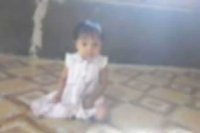 Atqia Nabila, bocah cilik yang mengalami jantung bocor.