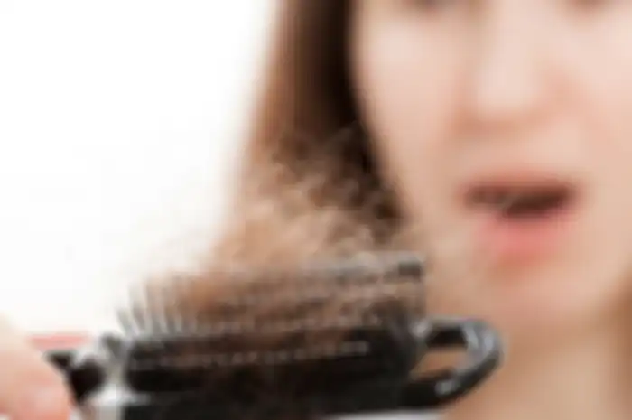 10 Cara untuk Mengatasi Rambut Rontok