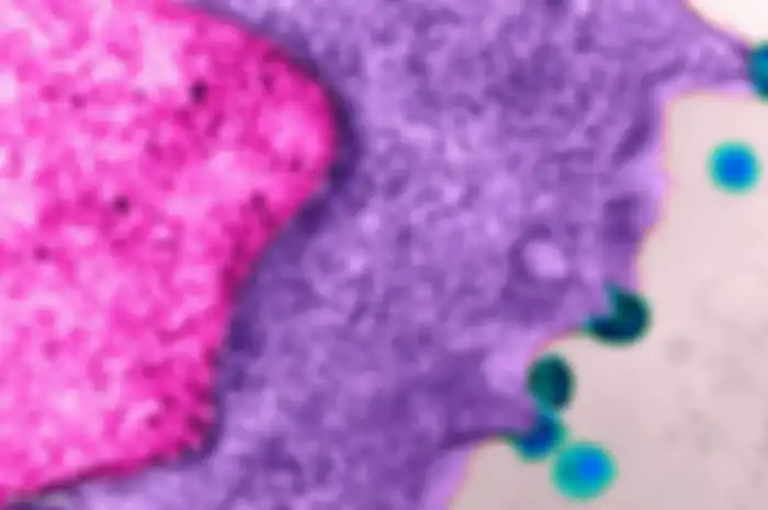 Ditemukan, Tipe Terbaru HIV yang Lebih Menular