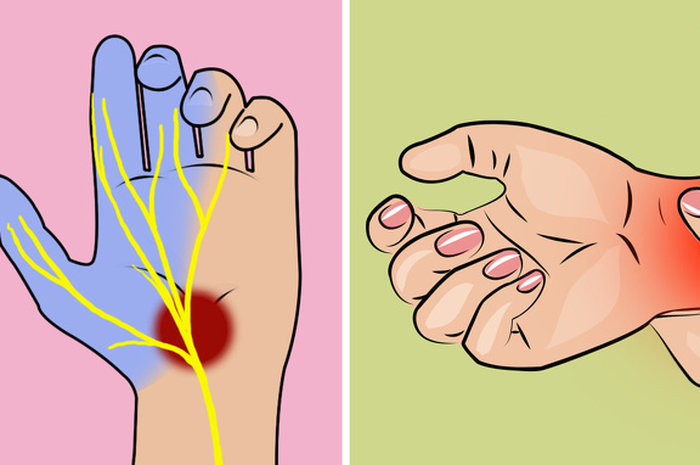 Kesemutan di tangan atau kaki bisa sangat mengganggu. Namun, kadang-kadang masalah ini bisa menjadi tanda masalah mendasar serius lainnya.