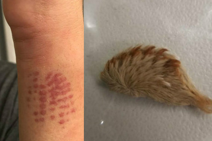 Hewan ini dikenal dengan nama puss carterpilla dengan nama ilmiah Megalopyge operularis, hewan yang disebut paling beracun di Amerika Serikat.