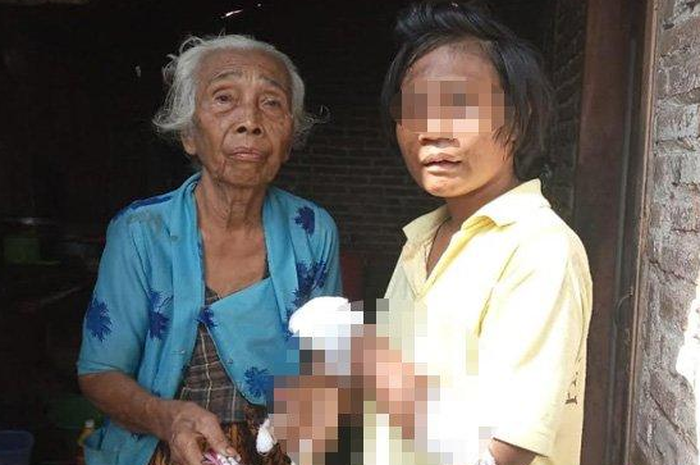 Kondisi pasien apabila kambuh, cenderung menyakiti diri sendiri, salah satunya dengan menggigit jari-jari tangannya sampai berdarah.