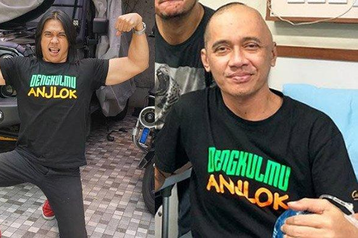Kanker otak, seperti yang diderita oleh Agung Hercules, ternyata bisa dipicu oleh hal-hal yang justru sangat akrab dengan anak-anak.