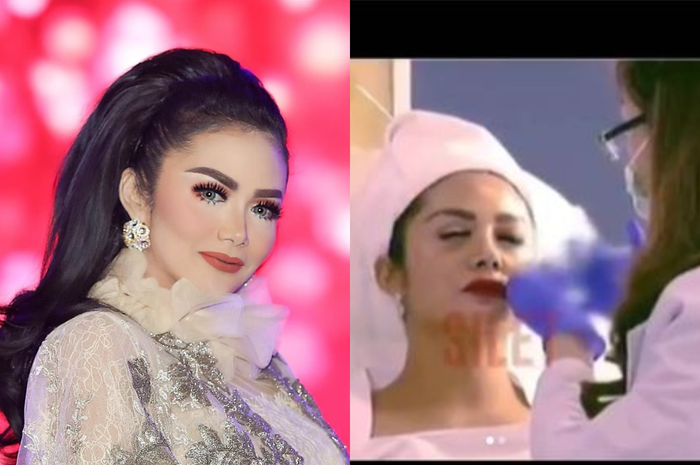 Penampilannya nyaris sempurna, Krisdayanti akui suntik DNA dari sperma ikan salmon, apa saja manfaatnya untuk penampilan?