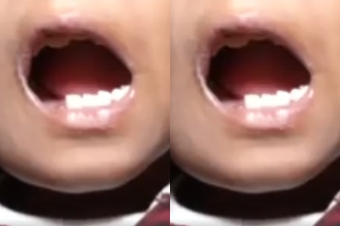 Sebuah kondisi medis aneh terjadi pada seorang bocah lelaki berusia 7 tahun. Anak tersebut memiliki 526 gigi di dalam mulutnya.