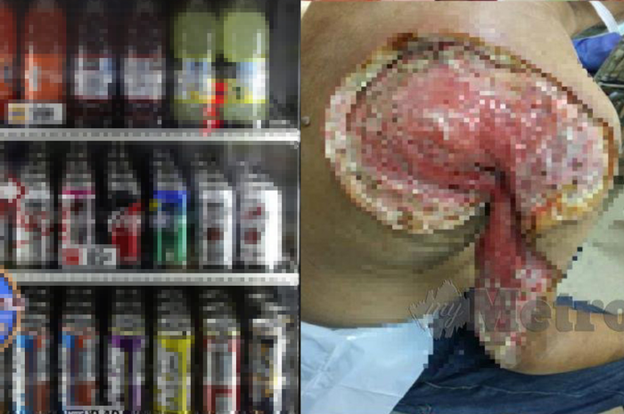 Pria tersebut bernama Mohd Razin Mohammed, diakatakan penyebab adalah penyakit diabetes yang dideritanya pada usia 40 tahun.
