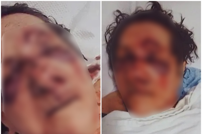 Alih-alih hidup dengan baik dengan perawatan terbaik dari staf panti jompo, tubuhnya justru babak belur.