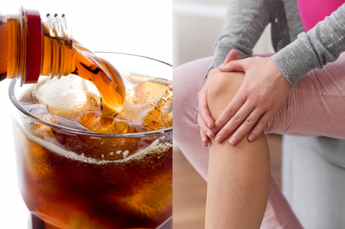 Osteoartritis, yang ditandai dengan tulang yang semakin lemah dan rapuh, sebagian besar menyerang orang dewasa yang lebih tua.