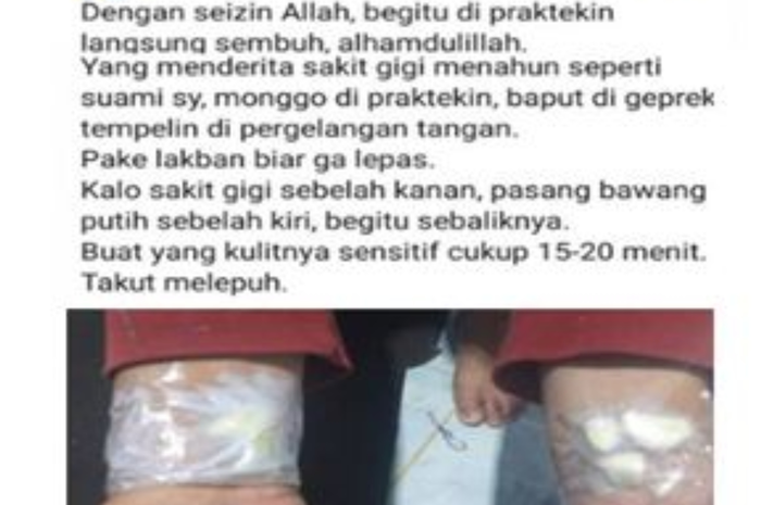 Seseorang menempelkan bawang putih di pergelangan tangan dan caption disebutkan bahwa cara ini dapat menyembuhkan sakit gigi.