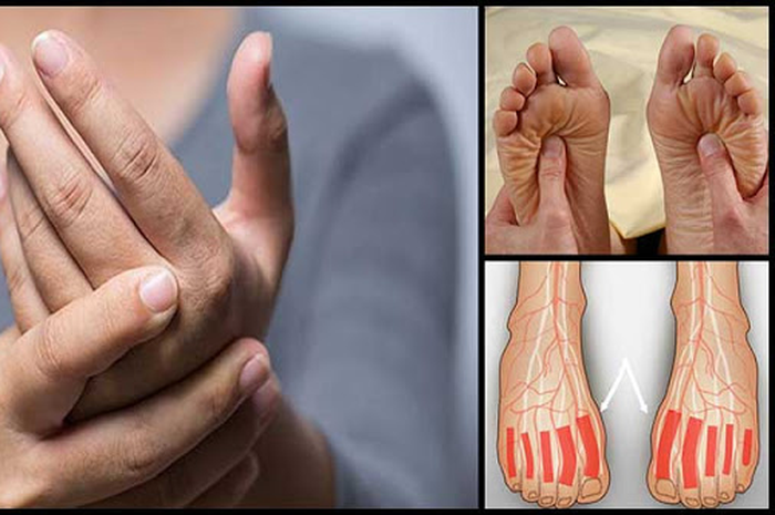 Neuropati diabetes adalah jenis kerusakan saraf akibat diabetes dan menyebabkan mati rasa dan kesemutan pada jari, jari kaki, tangan, dan kaki. 