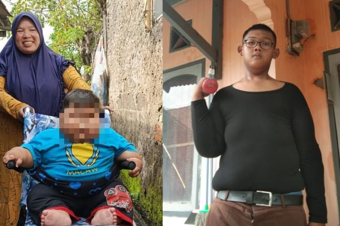 Kisah balita obesitas, usia 16 bulan tapi berat badannya capai 27 kg dan kisah&nbsp;Arya Permana (14).