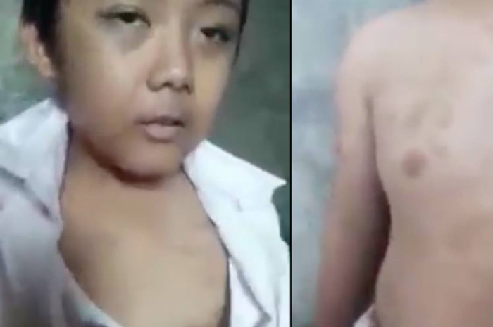 Seorang anak yang masih duduk di bangku sekolah dasar mengalami penyiksaan yang bertubi-tubi oleh ibunya sendiri.