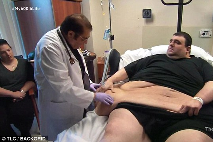 Robert dinyatakan mengalami obesitas yang buruk oleh dokter, namun berhasil menurunkan berat badannya hingga 56 kilogram dalam bulan pertamanya.