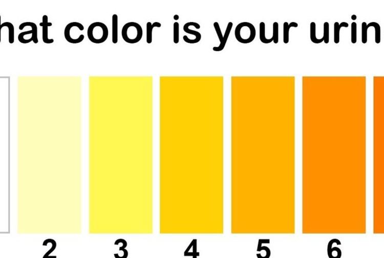 10 Warna Urine dan Artinya Bagi Kesehatan, Jangan Disepelekan! Semua
