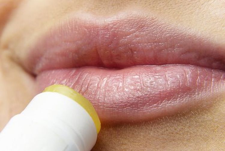 Bibir Pecah: Penyebab dan Cara Mengatasinya