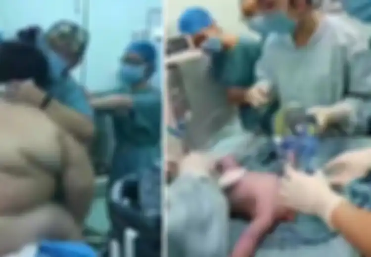 Kerahkan 16 Bidan dan Ahli Karena Kesulitan Tangani Persalinan Wanita Berberat 127 Kg, Beginilah Kondisi Bayi Itu Kemudian