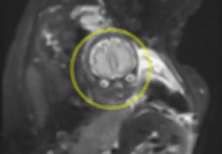 Bukannya Kaget, Pasangan Ini Justru Terpingkal-pingkal Setelah Melihat Foto MRI Anaknya