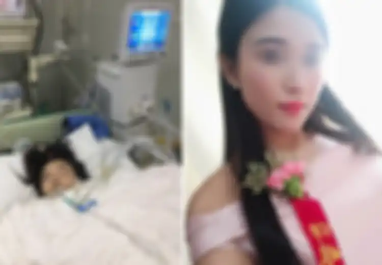 Mengenaskan, Jadi Bridesmaid di Dua Pernikahan Tanpa Istirahat, Kaki Kanan Wanita Ini Harus Amputasi