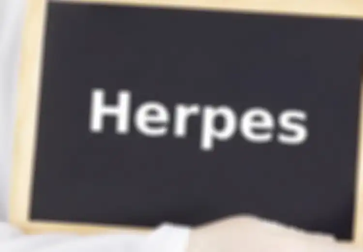Kasihan, Bayi Berusia 3 Bulan Ini Terinfeksi Herpes Setelah Dicium Ibunya di Bibir Setiap Saat