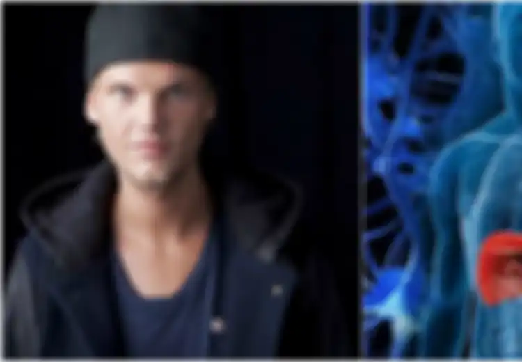DJ Avicii Derita Penyakit Pankreatitis Akut, Gejalanya Mirip dengan Penyakit 'Biasa'