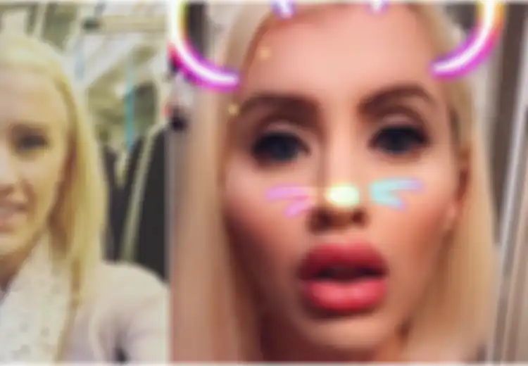 Berjuang Melawan Kanker, Wanita Ini Lakukan Operasi agar Mirip Barbie dari Gelontoran Uang Sugar Daddy-nya