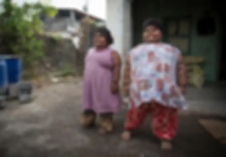 (Foto) Ketika Dua Kakak Beradik India Ini Menjalani Operasi Akibat Obesita: Coba Tengok Sarapan Keduanya!