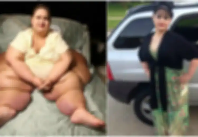 Keponakannya Disangka Tewas Karena Ketiban Tubuh 453 Kg-nya, Kini Mayra Bisa Langsing Molek Begini