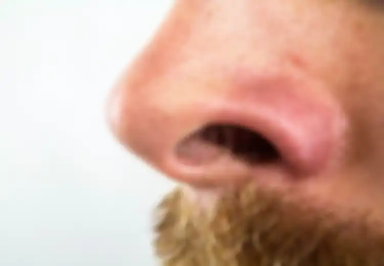 Cabut Bulu Hidung Memang ‘Asyik’, Tapi Ternyata Dampaknya Sangat Berbahaya