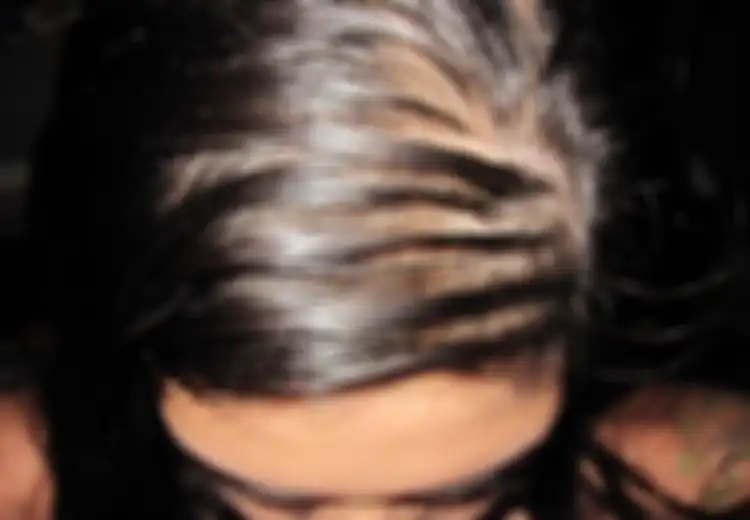 Rambut Sangat Berminyak, Jangan-jangan Anda Sering Gonta-ganti Produk Perawatan Rambut