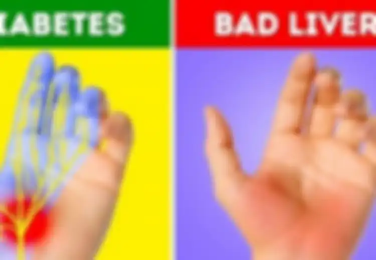 Mulai Diabetes Hingga Liver, Inilah Penyakit Berbahaya yang Dapat Dideteksi Lewat Tangan Anda