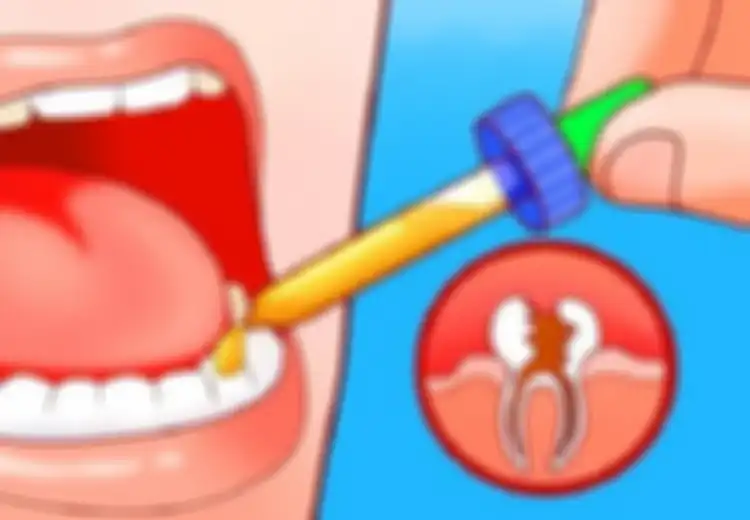 Hanya 1 Menit, Sakit Gigi Tak Tertahan Reda dengan 5 Bahan Alami ini