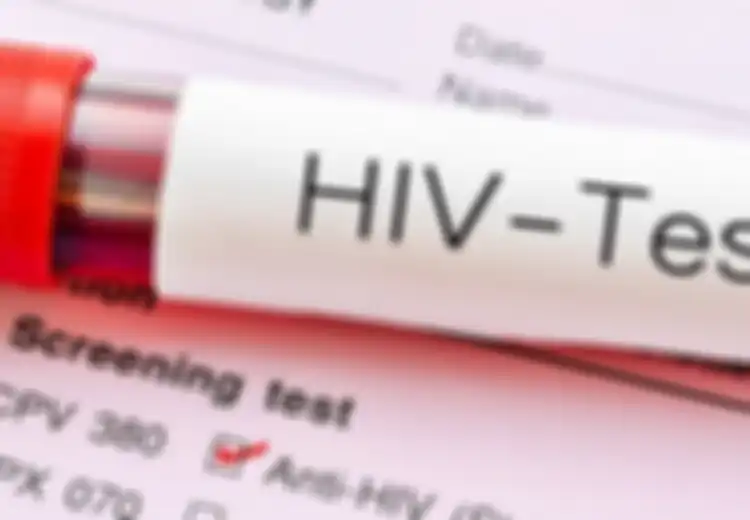 3 Bocah Penderita HIV Dikucilkan: Penyebab Terbesar HIV Memang Hubungan Seksual, Tapi Jangan Abaikan Penyebab Ini