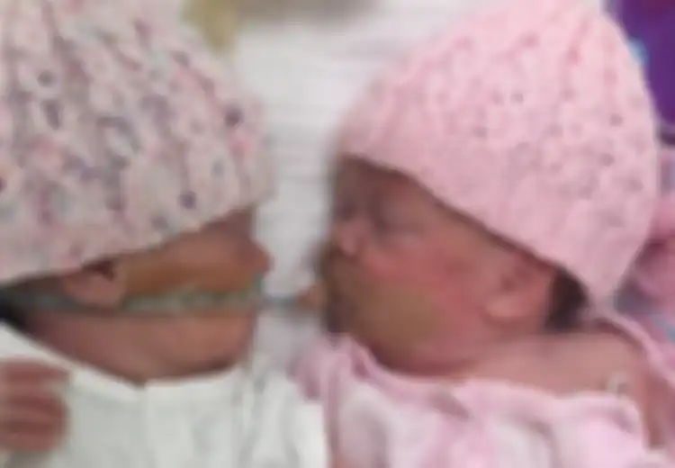 Bikin Nangis, Inilah Momen Mengharukan Ketika Bayi Kembar Memeluk Kembarannya yang Sedang Sekarat