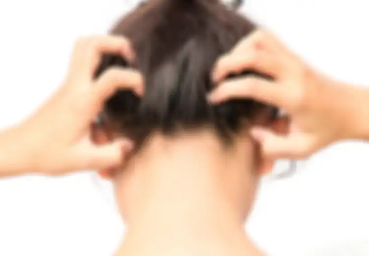 Rambut Anda Berketombe? Gunakan Saja Bahan Ini Untuk Menghilangkannya!