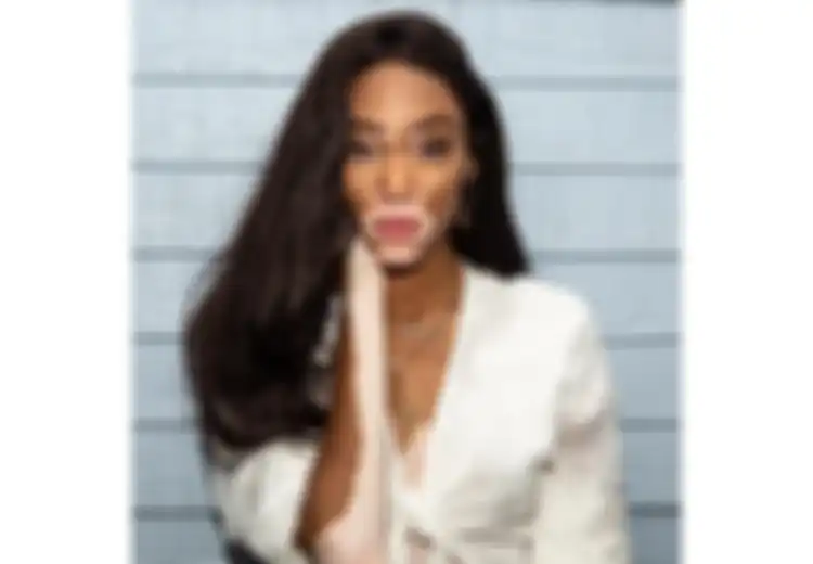 Dulu Dibully Karena Kulitnya, Winnie Harlow Kini Jadi Model Victoria’s Secret