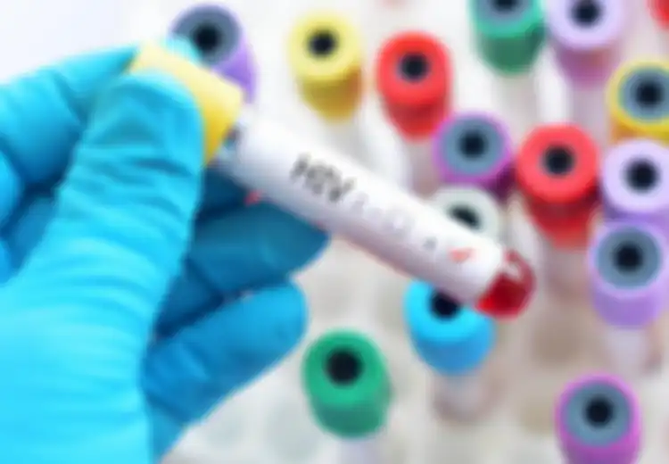3 Siswa SD yang Tertular HIV Mau Diusir, Ini Alasan Remaja Rentan Terkena HIV