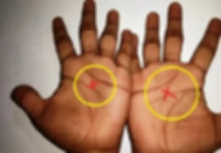 Lihat Telapak Tangan Anda Sekarang, Apakah Memiliki Tanda X yang Langka Ini? Inilah Arti Tanda Tersebut