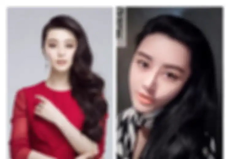 Demi Mirip Artis Idola, Wanita Ini Rela Jalani Operasi Plastik Hingga 8 Tahun, Lihat Hasilnya Ini!