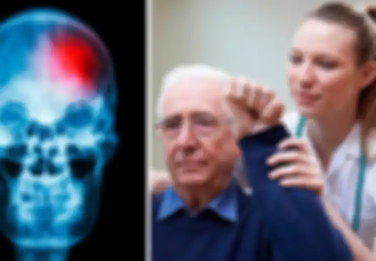 Ini 6 Peringatan Stroke akan Menyerang Anda, Jangan Abaikan!