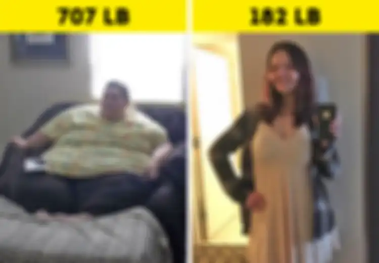 Inilah Foto Before-After 5 Wanita Penderita Obesitas, Sungguh Manglingi Setelah Mereka Kurus!